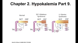 Hypokalemia Part 9 Case Studies [upl. by Kcirdet]