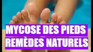 👉 MYCOSE DES PIEDS ★★★★★ REMÈDES NATURELS [upl. by Kristofer160]