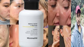 Minimalist Alpha Lipoic  Glycolic 7 Cleanser  Honest Review [upl. by Aneliram363]