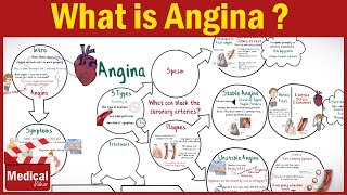 Pharmacology  What is Angina Pectoris  Types of Angina Symptoms Causes ampTreatment FROM A TO Z [upl. by Elak705]