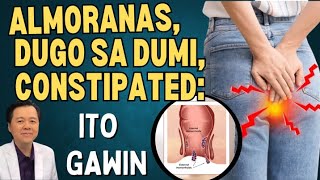 Almoranas Dugo sa Dumi Constipated Ito Gawin By Doc Willie Ong [upl. by Dorothee]