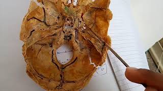 CONTENTS of pterygopalatine fossa PTERYGOPALATINE GANGLION simple explanation part 2 [upl. by Swisher693]