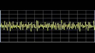 Lou Gehrigs Disease ALSAmyotrophic Lateral Sclerosis  Rife Frequencies [upl. by Lehpar]