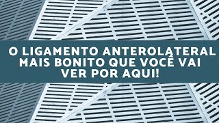 Ressonância Magnética O Ligamento Anterolateral do Joelho mais Bonito que você vai ver por aqui [upl. by Doty]