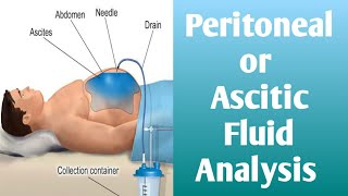 Peritoneal Fluid  Ascitic Fluid Analysis [upl. by Etteuqaj]