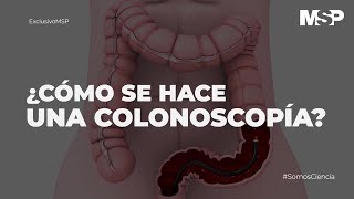 ¿Cómo se hace una colonoscopía ExclusivoMSP [upl. by Inilahs]