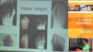 14 Doris Böhm Optimale Beweglichkeit mit der DorSanaMethode  Hüftstellung und Hallux valgus [upl. by Whale853]