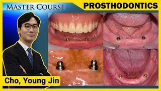 Master Course Season2 PROSTHODONTICS Solitary type Overdenture [upl. by Yerxa]