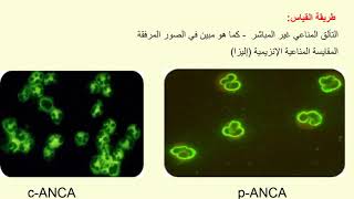 تحليل أضداد سيتوبلازما الخلايا المعتدلة AntiNeutrophil Cytoplasmic Antibodies Test [upl. by Olsewski330]