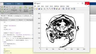 Matlab Dicom 3d [upl. by Akcirred]