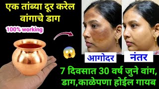 ना क्रीम ना पार्लर घरगुती पद्धतीने घालवा वांग आणि काळवटपणा 😱 kitchen tips  marathi kitchen  Tadka [upl. by Helban]