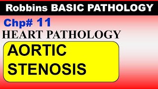 Chp11 Robbins Patho  Heart Pathology  Calcific Aortic Stenosis  Dr Asif Lectures [upl. by Elroy]