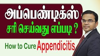 அப்பெண்டிக்ஸ் சரி செய்வது எப்படி HOW TO CURE APPENTICITIS Laparoscopy Surgery [upl. by Olva747]