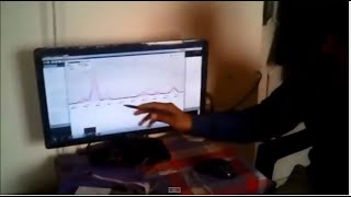 Brain Waves Visualization EEG [upl. by Errick933]