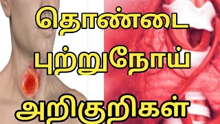 தொண்டை புற்றுநோய் அறிகுறிகள்தொண்டை கேன்சர்Throat cancer symptoms in Tamilcancer symptoms in Tamil [upl. by Adrianna]