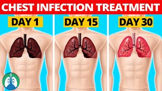 7 Natural Chest Infection Treatments Home Remedies [upl. by Fleurette663]