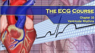 The ECG Course  Ventricular Rhythms [upl. by Schreiber]