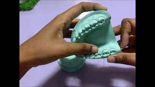 Ernst Ligature procedure for intermaxillary wiring on dental model [upl. by Lindly193]