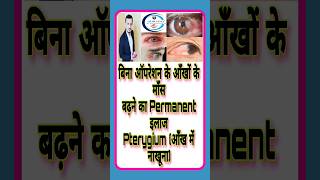 बिना ऑपरेशन के आँखों के माँसबढ़ने का Permanent इलाजPterygium आँख में नाखूना shorts youtubeahorts [upl. by Attennaej]