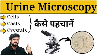 Microscopic Examination of Urine  Urine Analysis in Hindi  Crystals  Casts  Lab Practical [upl. by Aenneea]