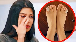 Kourtney Kardashian Reveals Shocking Foot Injury [upl. by Ecirtnahs470]