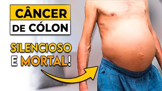 MUITO CUIDADO Isto pode ser sinal de CÂNCER de COLON │ Sintomas de Câncer de Intestino [upl. by Lavena]