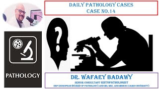 DAILY PATHOLOGY CASES CASE NO 14 BY DR WAFAEY BADAWY [upl. by Sonitnatsok755]