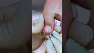 Perfect Pedicure Watch the Transformation 💅✨ [upl. by Collen]