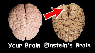 How was Albert Einsteins Brain Different  What made him so Genius [upl. by Huesman]