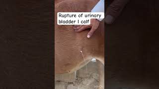 Rupture of urinary bladder l dr Umar khan [upl. by Hpseoj604]