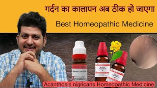 गर्दन का कालापन अब ठीक हो जाएगा  Homeopathic Medicine  Acanthosis nigricans [upl. by Vokaay311]