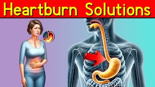 Heartburn Solutions How to Treat Acid Reflux and Shocking Effects of Untreated Heartburn [upl. by Akemaj]