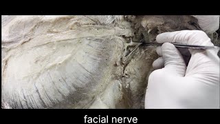 Facial nerve anatomy [upl. by Stevena]