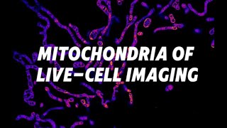 Livecell imaging of mitochondria ｜chinetekscientific1375 [upl. by Howland459]