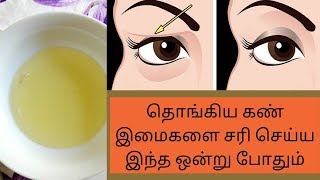 How to cure sagging eyestamil [upl. by Eahsed686]