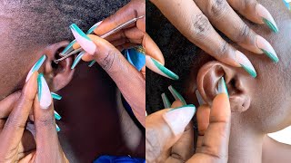 asmr ear cleaning real person [upl. by Allicirp]