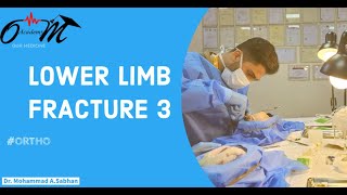 Lower limb fracture  Lec 3 [upl. by Marietta]