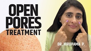 Open Pores  Open Pores Treatment Open Pores video Open Pores cream 2024 [upl. by Rugg200]