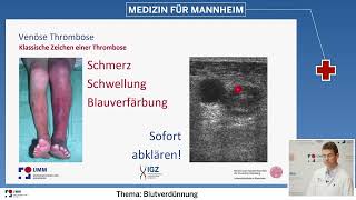 Blutverdünnung Behandlung von Thrombosen [upl. by Saberio730]