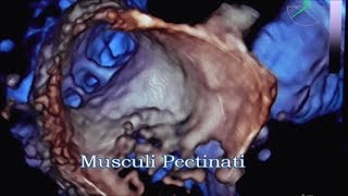 Musculi Pectinati [upl. by Cecily]