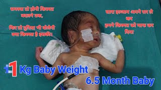 Preterm baby boy with 1 kg weight  cute viral viralvideo doctor medical shorts [upl. by Icram]