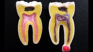 Remédio caseiro para dor de dente [upl. by Atil]