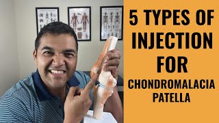 Top 5 Injection Options For Chondromalacia Patella Knee Pain Relief [upl. by Balas]