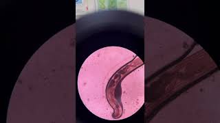 Enterobius vermicularis medtech parasite microscopy [upl. by Amador157]