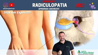 COMO TRATAR A RADICULOPATIA COM TRATAMENTO COMPLETO EM RCI [upl. by Gibson260]