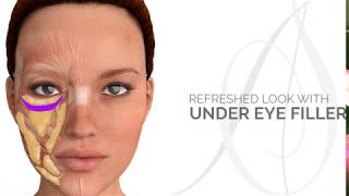 Having a Refreshed Look With Under Eye Filler [upl. by Bayly]