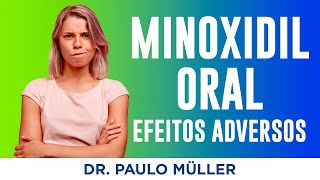 Quais os Efeitos Colaterais Mais comuns do Minoxidil Oral – Dr Paulo Müller Dermatologista [upl. by Ahsennek]