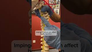 Scoliosis complications😰chiropracticfirst chiropractic trend shorts [upl. by Restivo]