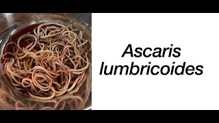 Ascaris lumbricoides Ciclo de vida Síntomas y Tratamiento  Parasitosis intestinal [upl. by Ardet]