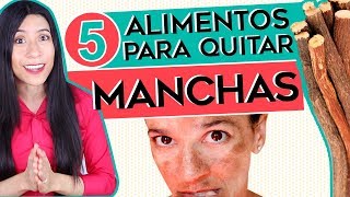 5 Alimentos para QUITAR MANCHAS  Remedios Caseros para Manchas [upl. by Chrisoula573]